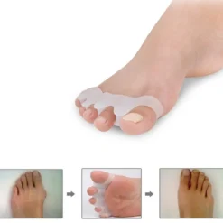 Tåspridare för Hallux Valgus stöd 1 par